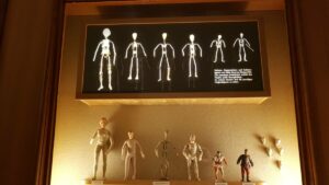 Röntgenbilder Käthe Kruse Puppen
